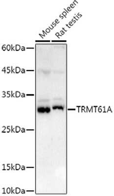 Western Blot: TRMT61A AntibodyAzide and BSA Free [NBP2-94200]